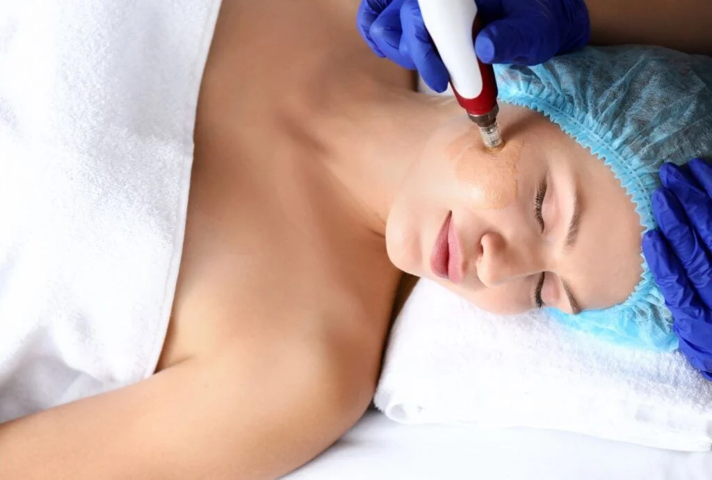 Curso presencial de Dermapen y BB Glow