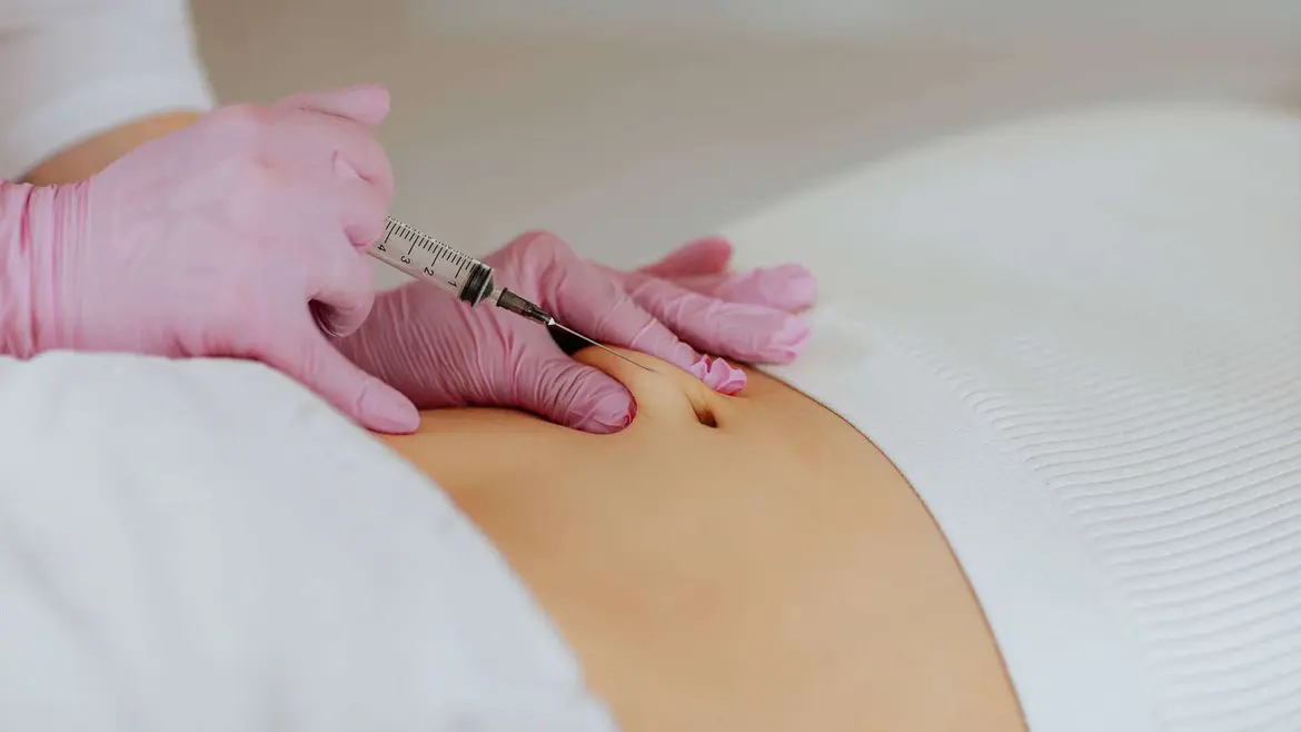 Carboxiterapia